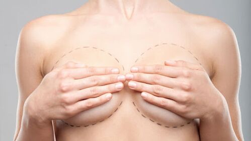 Operational Breast Awards -functies
