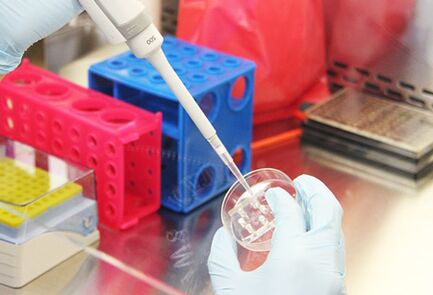 Onderzoek van de tests van de patiënt vóór het uitvoeren van augmentatie-mammoplastiek