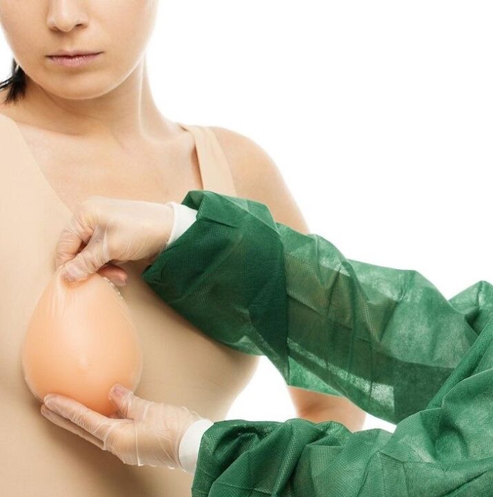 implantaten voor borstvergroting